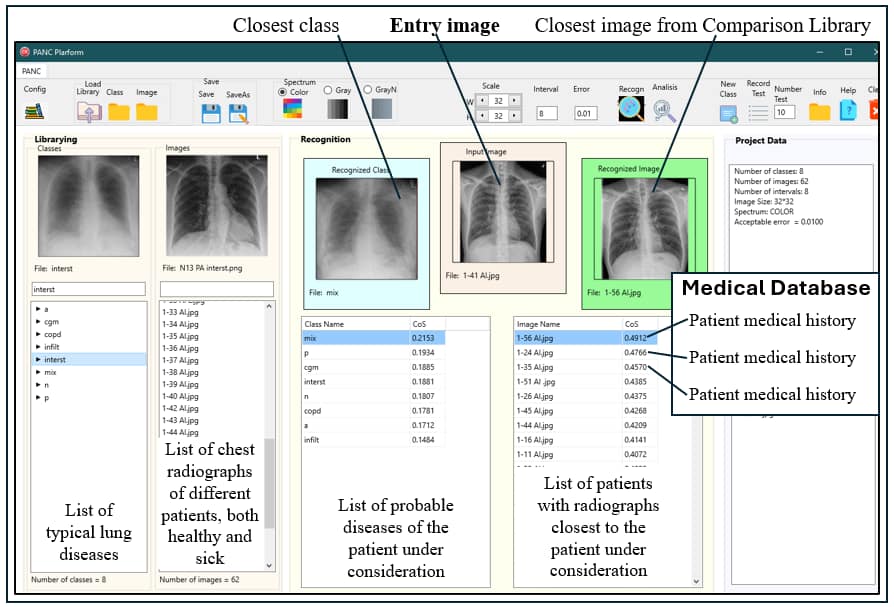 Screenshot of a software comparing radiograms